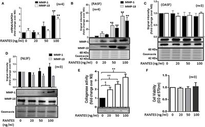 <mark class="highlighted">RANTES/CCL5</mark> Induces Collagen Degradation by Activating MMP-1 and MMP-13 Expression in Human Rheumatoid Arthritis Synovial Fibroblasts